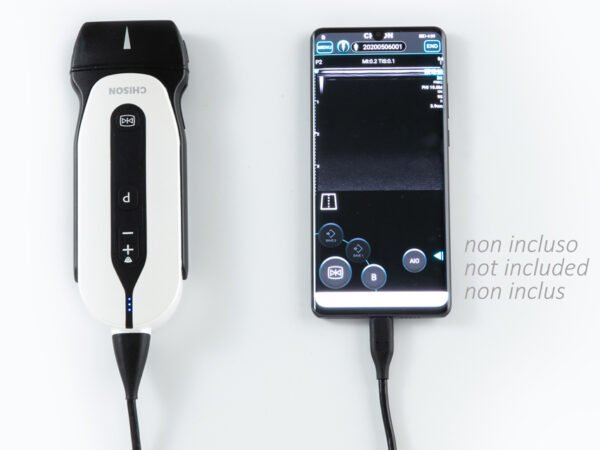 GIMA SONOEYE P2 DOPPLER COULEUR NUMÉRIQUE - Sonde Linear Array "33914 – Image 2