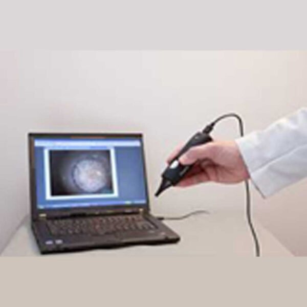 SPLENGER OTOSCOPE DIGITAL DE500, FIREFLY "DFIDE500A – Image 3