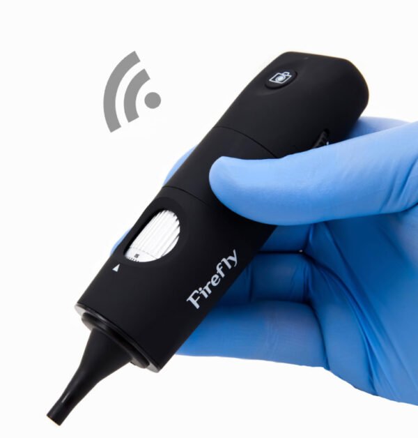 SPLENGER OTOSCOPE DIGITAL SANS FIL DE550, FIREFLY "DFIDE550