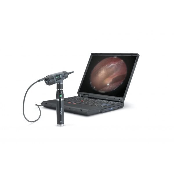 WELCH ALLYN WA OTOSCOPE MACROVIEW HALOGENE AVEC SOCLE CHARGEUR "WEL055 – Image 2